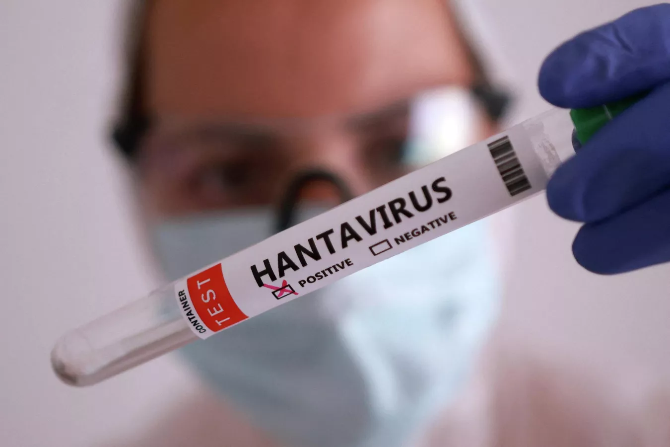 Cleaning Your Home Could Expose You to Hantavirus