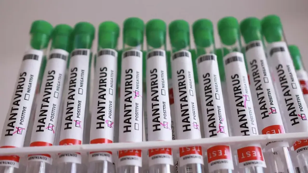 British Healthcare Worker Flown to London After Showing Hantavirus Symptoms